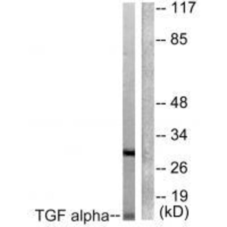 Western blot - TGF alpha Antibody from Signalway Antibody (33499) - Antibodies.com