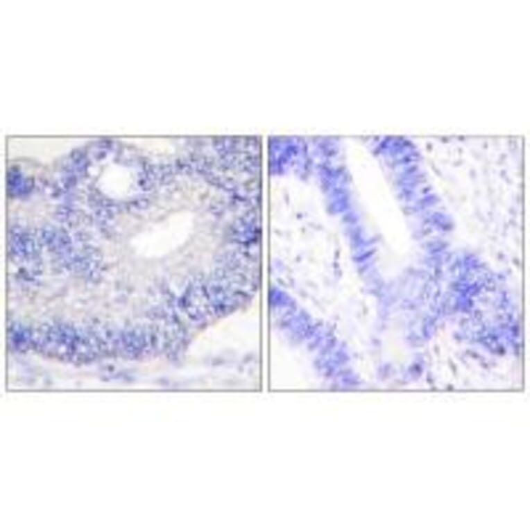 Immunohistochemistry - TGF alpha Antibody from Signalway Antibody (33499) - Antibodies.com