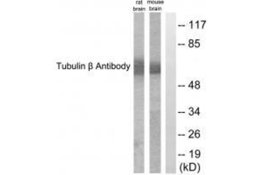 Western blot - Tubulin β Antibody from Signalway Antibody (33532) - Antibodies.com