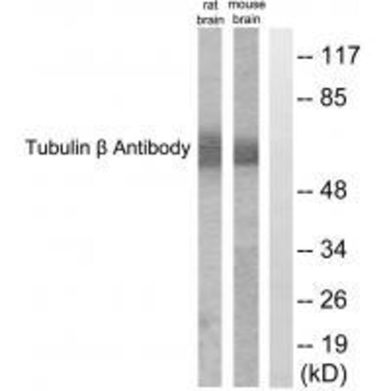 Western blot - Tubulin β Antibody from Signalway Antibody (33532) - Antibodies.com