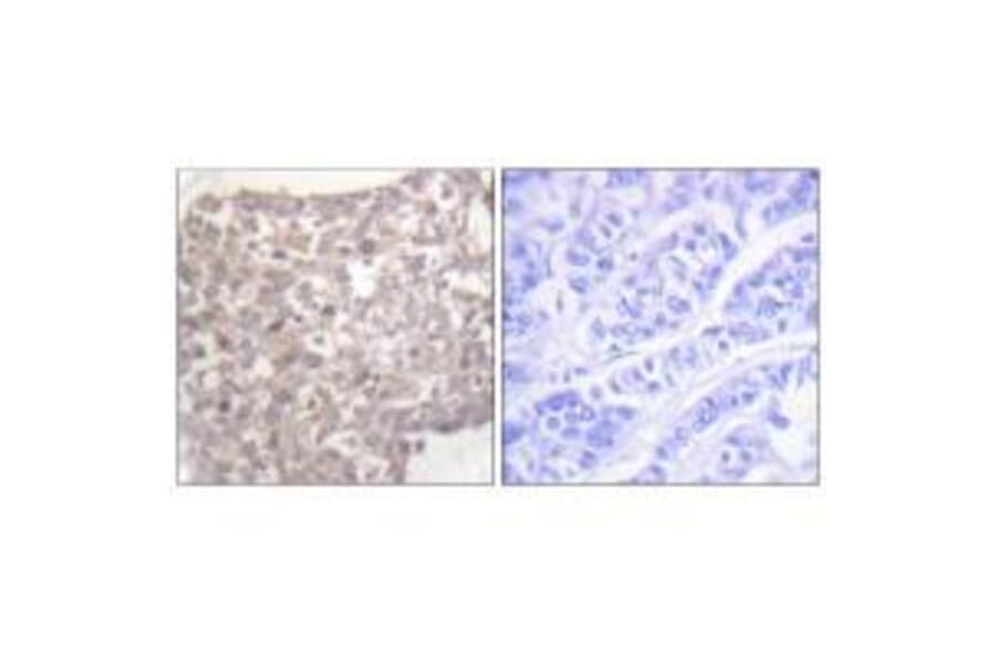 Immunohistochemistry - Tubulin γ Antibody from Signalway Antibody (33533) - Antibodies.com