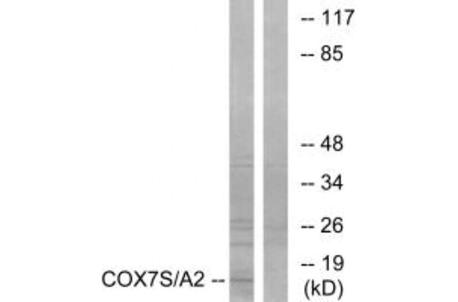 Western blot - COX7S/A2 Antibody from Signalway Antibody (34226) - Antibodies.com