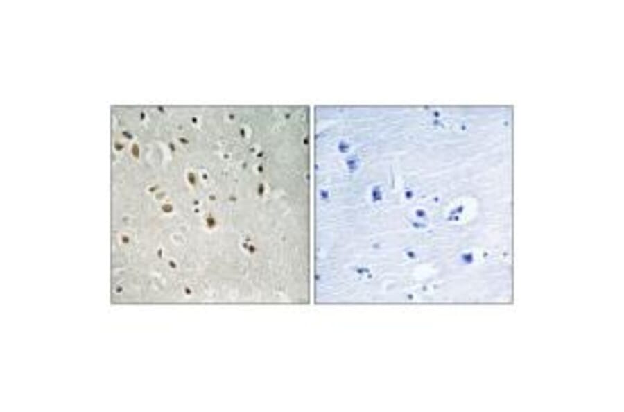 Immunohistochemistry - ANKRD20A3 Antibody from Signalway Antibody (34423) - Antibodies.com
