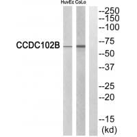 Western blot analysis of extracts from HuvEc cells and COLO cells, using CCDC102B antibody #34605.