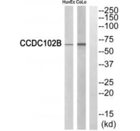 Western blot - CCDC102B Antibody from Signalway Antibody (34605) - Antibodies.com