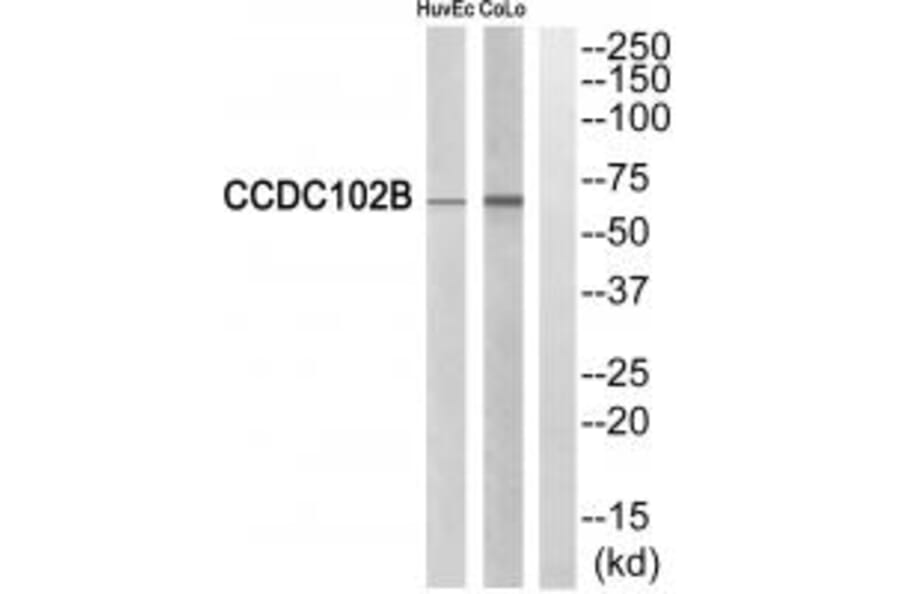 Western blot - CCDC102B Antibody from Signalway Antibody (34605) - Antibodies.com