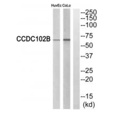 Western blot - CCDC102B Antibody from Signalway Antibody (34605) - Antibodies.com
