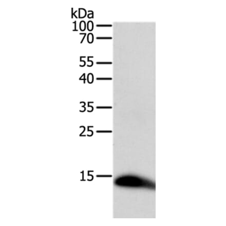 TNFRSF12A Antibody from Signalway Antibody (35709) - Antibodies.com