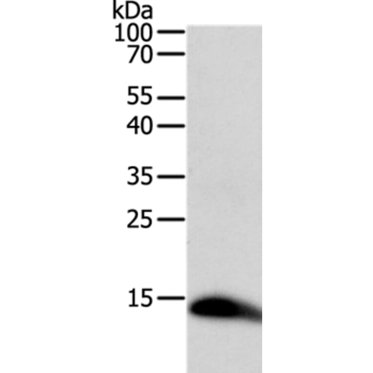 TNFRSF12A Antibody from Signalway Antibody (35709) - Antibodies.com
