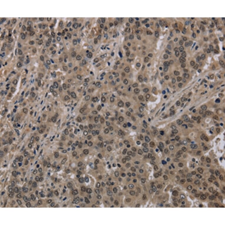 Immunohistochemistry - HIST1H2AH Antibody from Signalway Antibody (36518) - Antibodies.com
