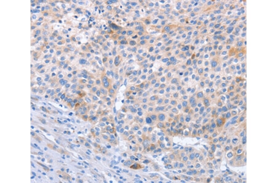 Immunohistochemistry - STK3/STK4 Antibody from Signalway Antibody (37462) - Antibodies.com