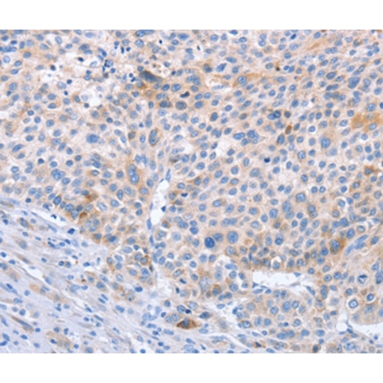 Immunohistochemistry - STK3/STK4 Antibody from Signalway Antibody (37462) - Antibodies.com