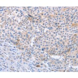 Immunohistochemistry - STK3/STK4 Antibody from Signalway Antibody (37462) - Antibodies.com
