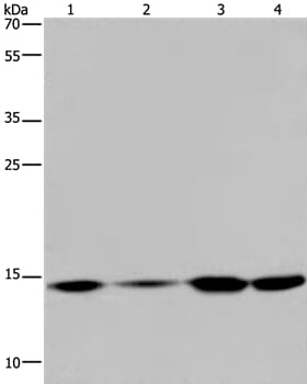 Gel: 10% SDS-PAGE Lysates (from left to right): Hela, 231 and K562 cell, human fetal brain tissue Amount of lysate: 40ug per lane Primary antibody: 1/200 dilution Secondary antibody dilution: 1/8000 Exposure time: 5 minutes