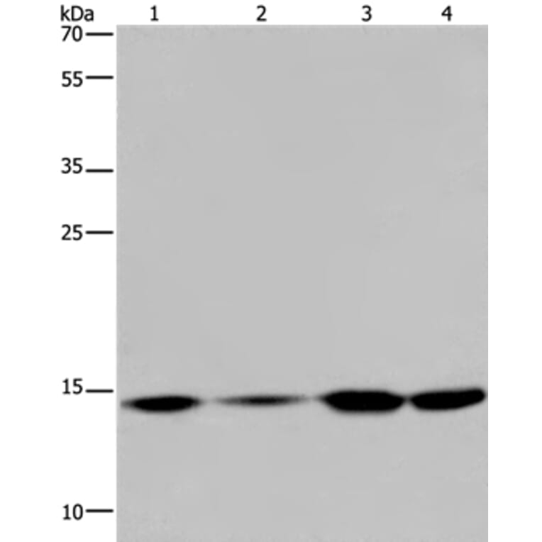 HIST1H2AB Antibody from Signalway Antibody (37620) - Antibodies.com