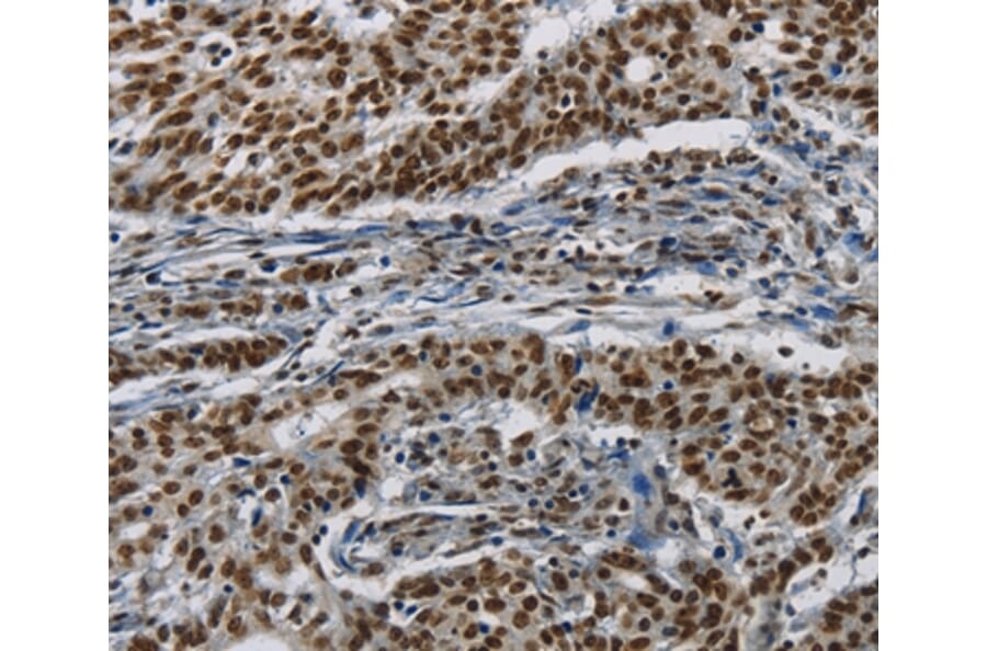 Immunohistochemistry - HIST1H2AB Antibody from Signalway Antibody (37620) - Antibodies.com