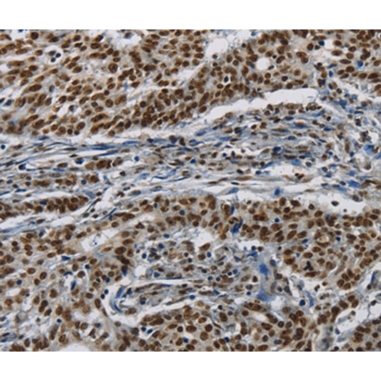 Immunohistochemistry - HIST1H2AB Antibody from Signalway Antibody (37620) - Antibodies.com