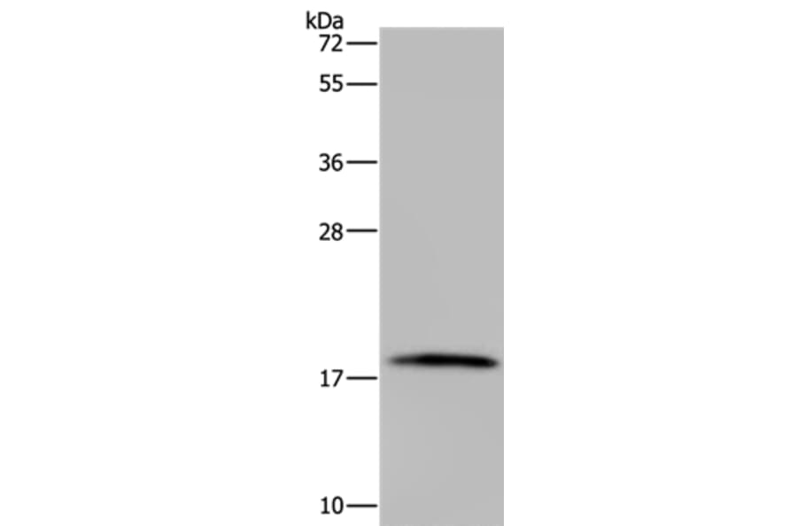 TNFRSF13C Antibody from Signalway Antibody (37764) - Antibodies.com