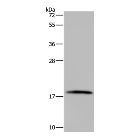 TNFRSF13C Antibody from Signalway Antibody (37764) - Antibodies.com