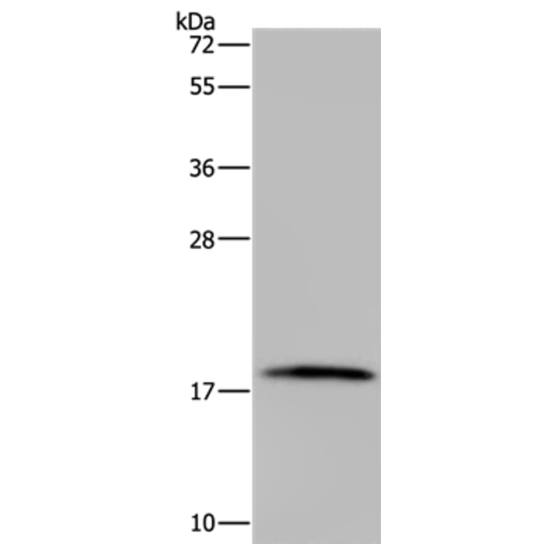 TNFRSF13C Antibody from Signalway Antibody (37764) - Antibodies.com