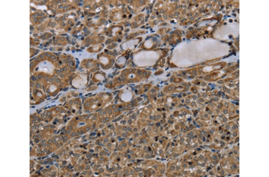 Immunohistochemistry - TNFRSF13C Antibody from Signalway Antibody (37764) - Antibodies.com