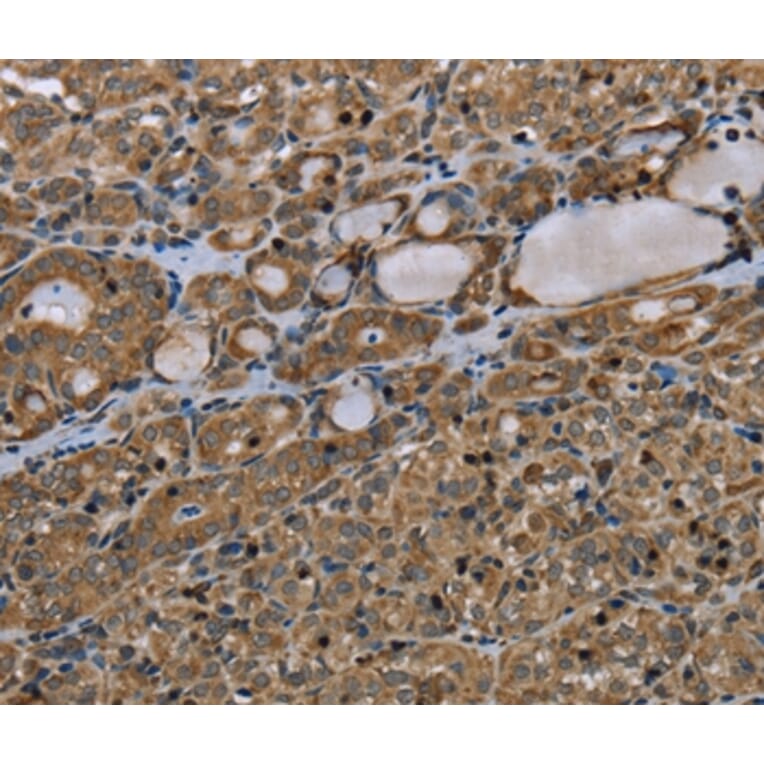 Immunohistochemistry - TNFRSF13C Antibody from Signalway Antibody (37764) - Antibodies.com