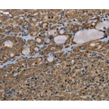 Immunohistochemistry - TNFRSF13C Antibody from Signalway Antibody (37764) - Antibodies.com