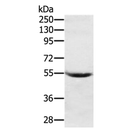 SERPING1 Antibody from Signalway Antibody (37916) - Antibodies.com