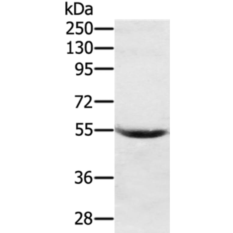 SERPING1 Antibody from Signalway Antibody (37916) - Antibodies.com