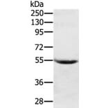 SERPING1 Antibody from Signalway Antibody (37916) - Antibodies.com