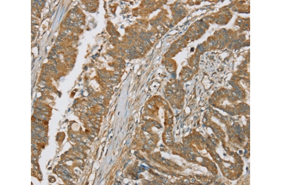 Immunohistochemistry - SERPING1 Antibody from Signalway Antibody (37916) - Antibodies.com