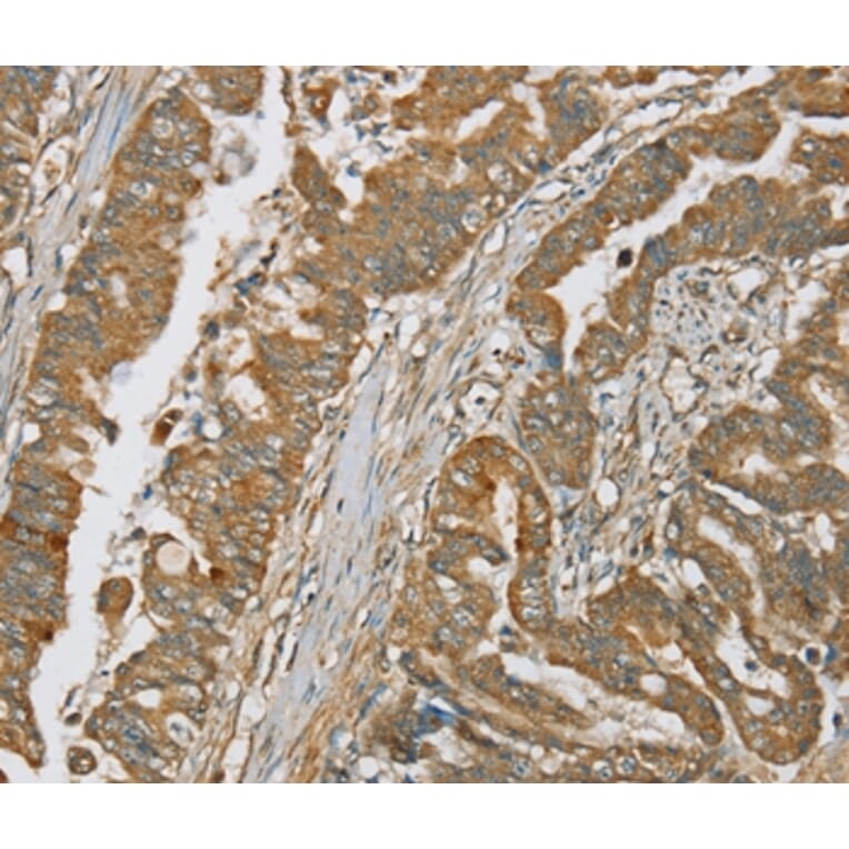 Immunohistochemistry - SERPING1 Antibody from Signalway Antibody (37916) - Antibodies.com