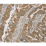 Immunohistochemistry - SERPING1 Antibody from Signalway Antibody (37916) - Antibodies.com