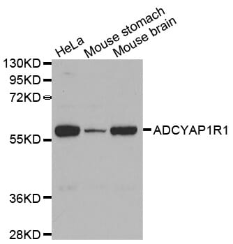Western blot analysis of extracts of various cell lines, using ADCYAP1R1 antibody. (1: Hela cell lysate 2: Mouse stomach tissue lysate 3: Brain tissue lysate).