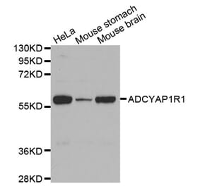 Western blot - ADCYAP1R1 antibody from Signalway Antibody (38591) - Antibodies.com