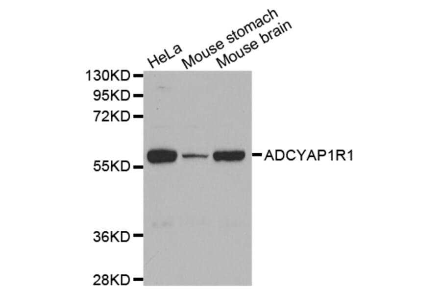 Western blot - ADCYAP1R1 antibody from Signalway Antibody (38591) - Antibodies.com