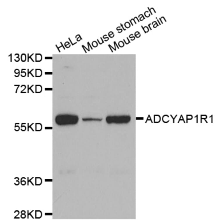 Western blot - ADCYAP1R1 antibody from Signalway Antibody (38591) - Antibodies.com