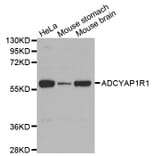 Western blot - ADCYAP1R1 antibody from Signalway Antibody (38591) - Antibodies.com