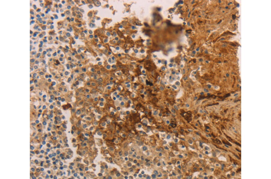 Immunohistochemistry - ADCYAP1R1 antibody from Signalway Antibody (38591) - Antibodies.com