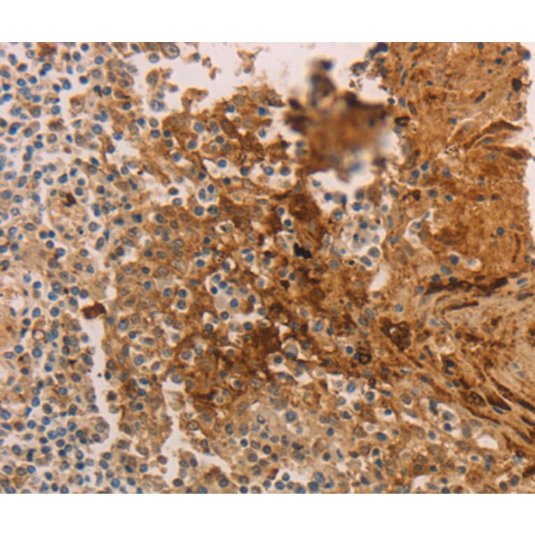 Immunohistochemistry - ADCYAP1R1 antibody from Signalway Antibody (38591) - Antibodies.com