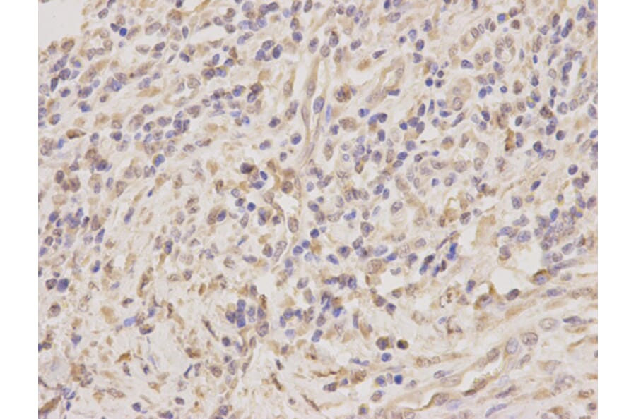 Immunohistochemistry - TNFRSF10D antibody from Signalway Antibody (38726) - Antibodies.com