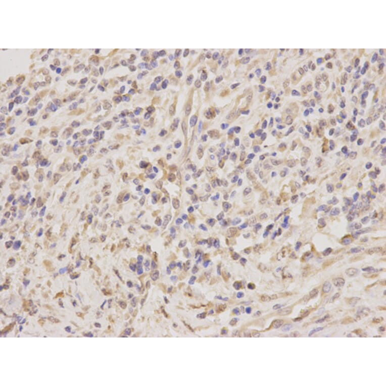 Immunohistochemistry - TNFRSF10D antibody from Signalway Antibody (38726) - Antibodies.com