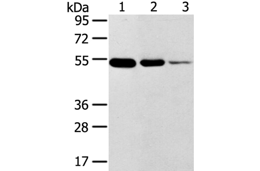 TMPRSS11F Antibody from Signalway Antibody (40254) - Antibodies.com