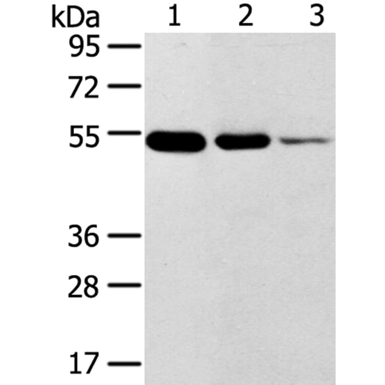 TMPRSS11F Antibody from Signalway Antibody (40254) - Antibodies.com