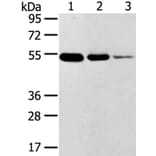 TMPRSS11F Antibody from Signalway Antibody (40254) - Antibodies.com