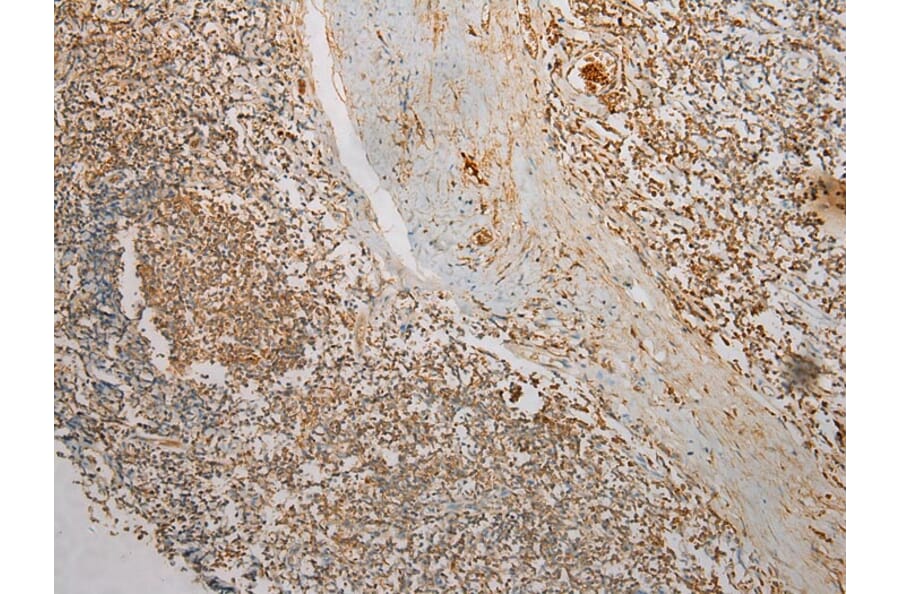 Immunohistochemistry - TMPRSS11F Antibody from Signalway Antibody (40254) - Antibodies.com