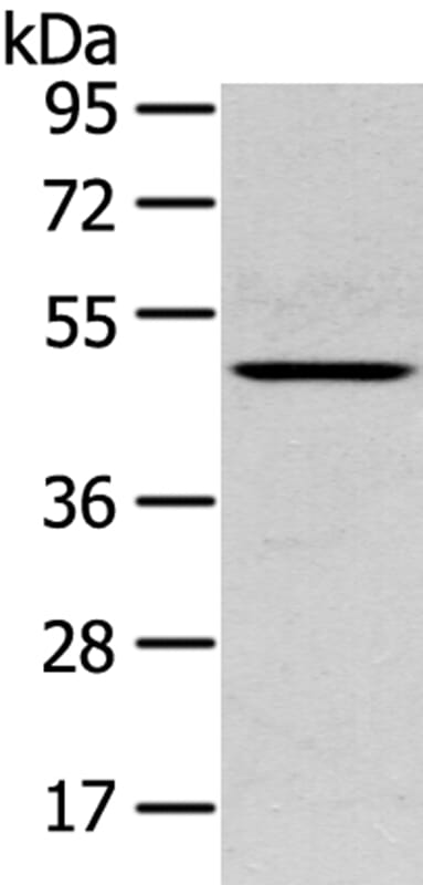 Gel: 8% SDS-PAGE Lysate: 40ug Mouse lung tissue. Primary antibody: 1/400 dilution Secondary antibody dilution: 1/8000Exposure time: 30 seconds