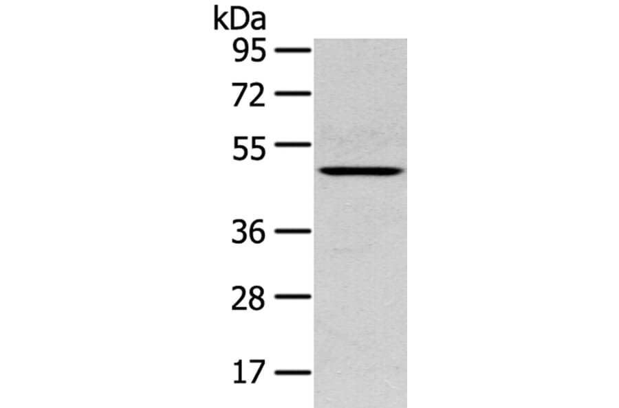 SERPINB11 Antibody from Signalway Antibody (40332) - Antibodies.com