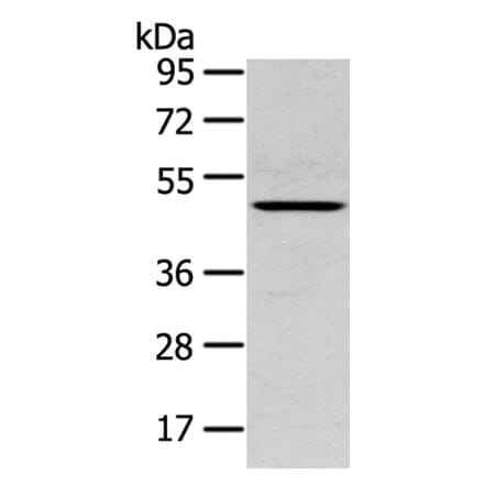 SERPINB11 Antibody from Signalway Antibody (40332) - Antibodies.com