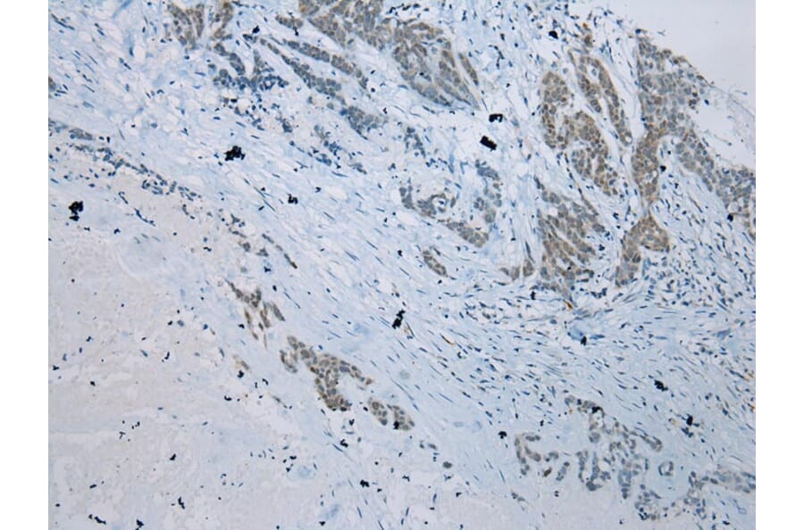 Immunohistochemistry - SERPINB11 Antibody from Signalway Antibody (40332) - Antibodies.com